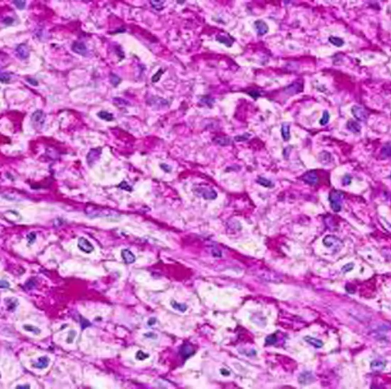 periodic acid schiff test